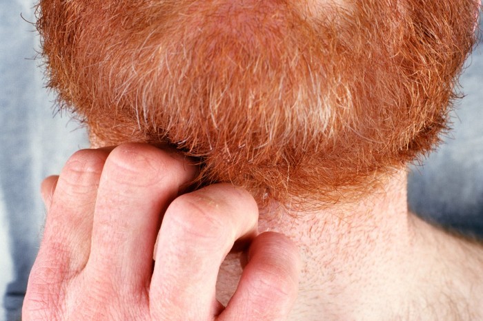 FUR_07: Ginger